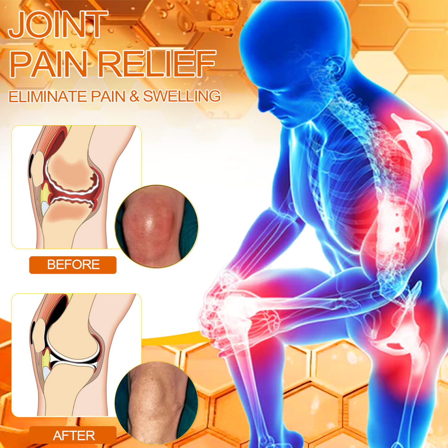 ArthroEase Bee Venom Arthritis Therapy Cream(Specially for older adults & AOA recommends)