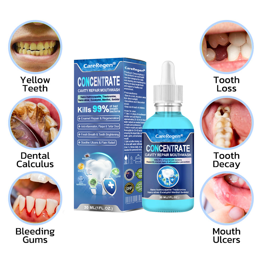 Official Store：🏆CareRegen® CONCENTRATE REPAIR MOUTHWASH(Dentist recommended)(Flying Off the Shelves: 100,000 Bottles Sold!)🎀