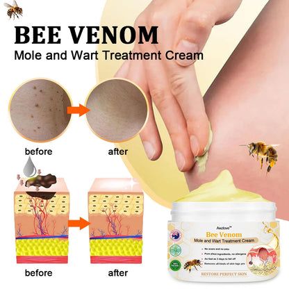 👩‍⚕️[🌟𝐎𝐟𝐟𝐢𝐜𝐢𝐚𝐥 𝐁𝐫𝐚𝐧𝐝 𝐒𝐭𝐨𝐫𝐞🌟] 𝐀𝐰𝐳𝐥𝐨𝐯𝐞™ 𝐁𝐞𝐞 𝐕𝐞𝐧𝐨𝐦 𝐌𝐨𝐥𝐞 𝐚𝐧𝐝 𝐖𝐚𝐫𝐭 𝐓𝐫𝐞𝐚𝐭𝐦𝐞𝐧𝐭 𝐂𝐫𝐞𝐚𝐦
