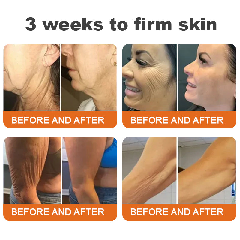 "Made and Shipped from AU| Awzlove® BOTOX Bee Venom All-in-one Treatment Cream | LAST DAY 80% OFF "