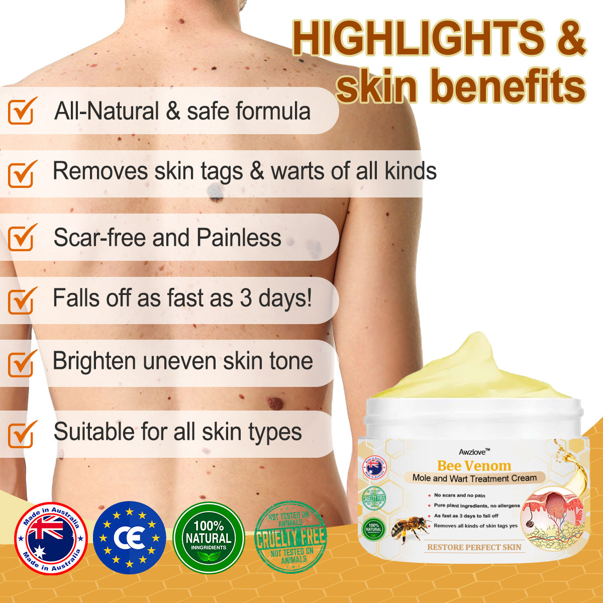 👩‍⚕️[🌟𝐎𝐟𝐟𝐢𝐜𝐢𝐚𝐥 𝐁𝐫𝐚𝐧𝐝 𝐒𝐭𝐨𝐫𝐞🌟] 𝐀𝐰𝐳𝐥𝐨𝐯𝐞™ 𝐁𝐞𝐞 𝐕𝐞𝐧𝐨𝐦 𝐌𝐨𝐥𝐞 𝐚𝐧𝐝 𝐖𝐚𝐫𝐭 𝐓𝐫𝐞𝐚𝐭𝐦𝐞𝐧𝐭 𝐂𝐫𝐞𝐚𝐦