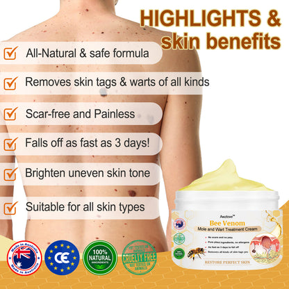 👩‍⚕️[🌟𝐎𝐟𝐟𝐢𝐜𝐢𝐚𝐥 𝐁𝐫𝐚𝐧𝐝 𝐒𝐭𝐨𝐫𝐞🌟] 𝐀𝐰𝐳𝐥𝐨𝐯𝐞™ 𝐁𝐞𝐞 𝐕𝐞𝐧𝐨𝐦 𝐌𝐨𝐥𝐞 𝐚𝐧𝐝 𝐖𝐚𝐫𝐭 𝐓𝐫𝐞𝐚𝐭𝐦𝐞𝐧𝐭 𝐂𝐫𝐞𝐚𝐦