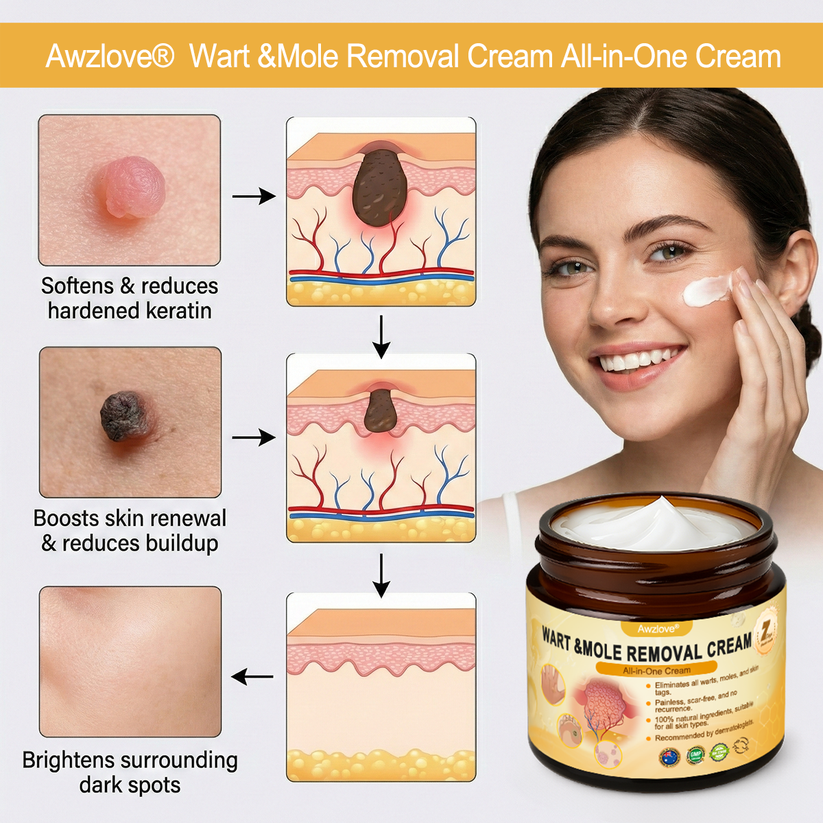 Made and Shipped from Australia ✨Awzlove® Wart & Mole Removal All-in-One Cream 🏆