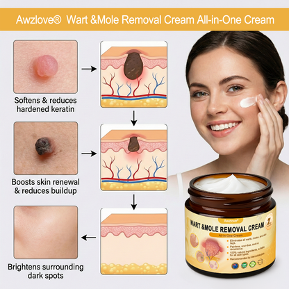 Made and Shipped from Australia ✨Awzlove® Wart & Mole Removal All-in-One Cream 🏆