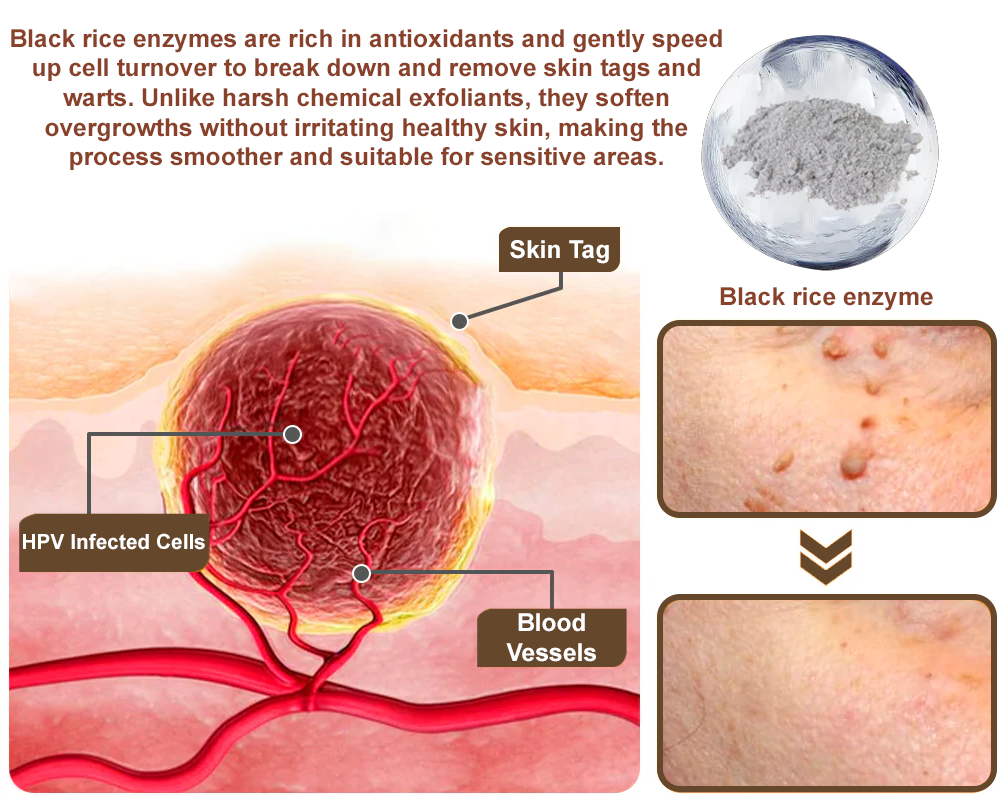 Awzlove® Black Rice Skin Repair Essence Cream ⚕️ TGA Certified (Removes warts and skin growths, improves keratin buildup and seborrheic dermatitis, follicular keratosis, age spots, and bruising)