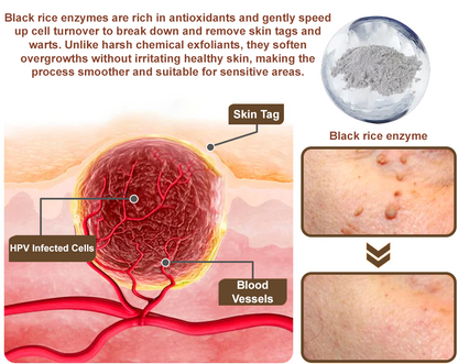 Awzlove® Black Rice Skin Repair Essence Cream ⚕️ TGA Certified (Removes warts and skin growths, improves keratin buildup and seborrheic dermatitis, follicular keratosis, age spots, and bruising)