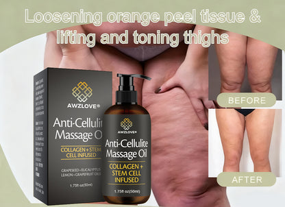 Awzlove® Luxurious Collagen & Stem Cell Anti-Cellulite Massage Oil💐 (🔥70% Off for a Limited Time!) 💐