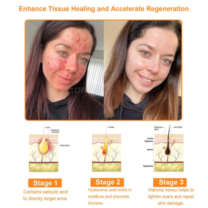 Awzlove™  Powerful All-Body Skin Treatment Cream👩‍⚕️ACD Recommends (🔥Limited time 50% discount)