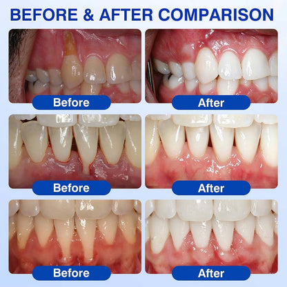 🦷 Healrize® GumRevive Gel for Regenerating the Tooth-Supporting Tissues (for Bleeding Gums, Receding Gums and Loose Teeth) 🐰