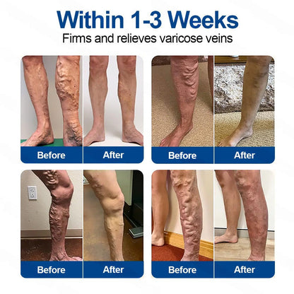 𝗛𝗲𝗮𝗹𝗿𝗶𝘇𝗲® 𝗩𝗲𝗶𝗻𝗧𝗮𝗿𝗴𝗲𝘁 𝗠𝗶𝗰𝗿𝗼𝗻𝗲𝗲𝗱𝗹𝗲 𝗣𝗮𝘁𝗰𝗵🌾🌿𝗜𝗻𝘀𝘁𝗮𝗻𝘁 𝗥𝗲𝗹𝗶𝗲𝗳, 𝗟𝗼𝗻𝗴-𝗧𝗲𝗿𝗺 𝗥𝗲𝘀𝘂𝗹𝘁𝘀 ✅🇦🇺