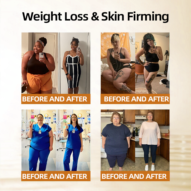 𝑶𝒇𝒇𝒊𝒄𝒊𝒂𝒍 𝑺𝒕𝒐𝒓𝒆  | 👩‍⚕️ 𝐇𝐞𝐚𝐥𝐫𝐢𝐳𝐞®𝐌𝐨𝐫𝐢𝐧𝐠𝐚 𝐁𝐞𝐫𝐛𝐞𝐫𝐢𝐧𝐞 𝟏𝟎-𝐢𝐧-𝟏 𝐌𝐢𝐜𝐫𝐨𝐠𝐫𝐚𝐧𝐮𝐥𝐞 𝐁𝐨𝐝𝐲-𝐒𝐡𝐚𝐩𝐢𝐧𝐠 𝐅𝐚𝐭-𝐁𝐮𝐫𝐧𝐢𝐧𝐠 𝐏𝐚𝐭𝐜𝐡(𝐎𝐧𝐜𝐞 𝐃𝐚𝐢𝐥𝐲, 𝐯𝐢𝐬𝐢𝐛𝐥𝐞 𝐜𝐡𝐚𝐧𝐠𝐞𝐬 𝐢𝐧 𝟕 𝐝𝐚𝐲𝐬）𝟓𝐗 𝐒𝐰𝐞𝐚𝐭 𝐏𝐫𝐨𝐝𝐮𝐜𝐭𝐢𝐨𝐧. 𝐅𝐨𝐫 𝐎𝐛𝐞𝐬𝐢𝐭𝐲, 𝐋𝐨𝐨𝐬𝐞 𝐒𝐤𝐢𝐧, 𝐃𝐢𝐚𝐛𝐞𝐭𝐞𝐬, 𝐒𝐥𝐞𝐞𝐩 𝐀𝐩𝐧𝐞𝐚, 𝐀𝐧𝐝 𝐉𝐨𝐢𝐧𝐭 𝐈𝐬𝐬𝐮𝐞𝐬🌞