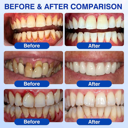 🦷 Healrize® GumRevive Gel for Regenerating the Tooth-Supporting Tissues (for Bleeding Gums, Receding Gums and Loose Teeth) 🐰
