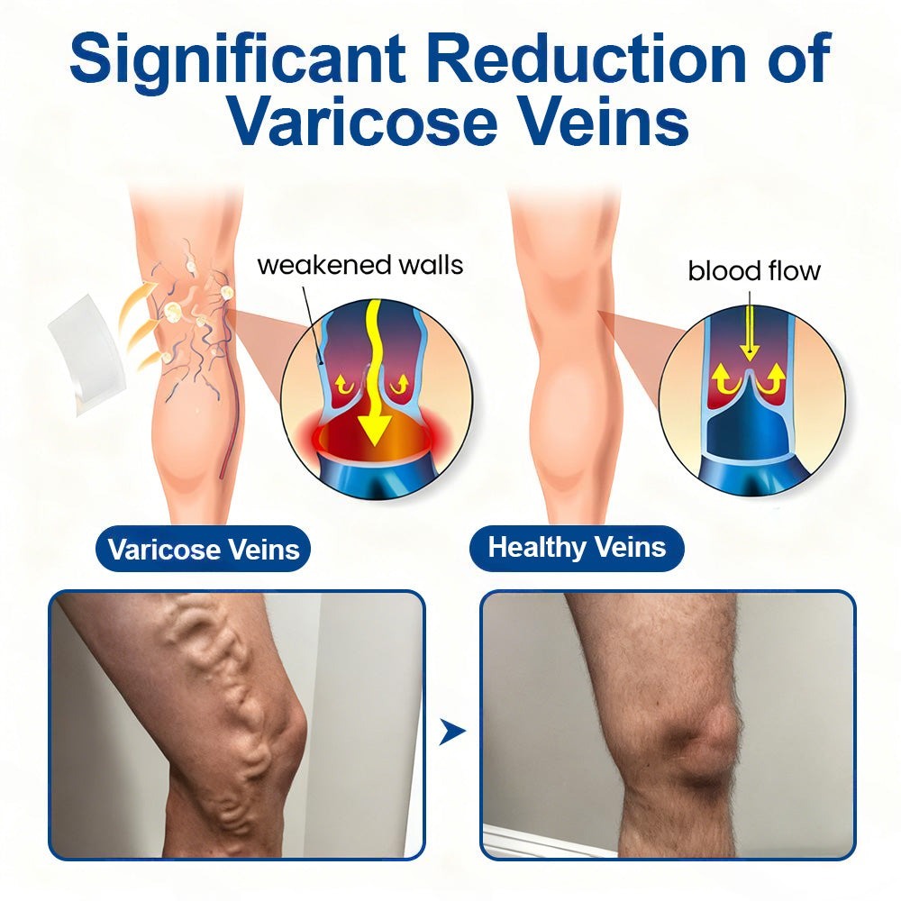 🇦🇺👨‍⚕️👍✅Healrize® VeinTarget Microneedle Patch👑Instant Relief, Long-Term Results 👑