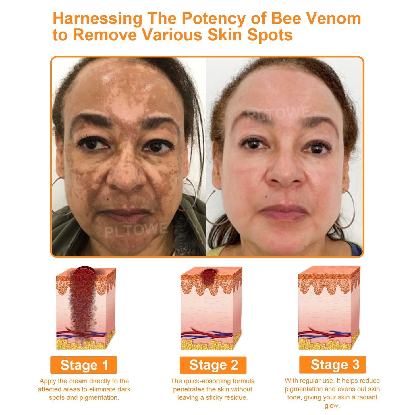 Awzlove™  Powerful All-Body Skin Treatment Cream👩‍⚕️ACD Recommends (🔥Limited time 50% discount)