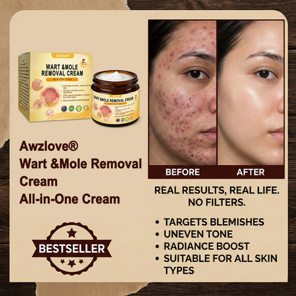 Made and Shipped from Australia ✨Awzlove® Wart & Mole Removal All-in-One Cream 🏆