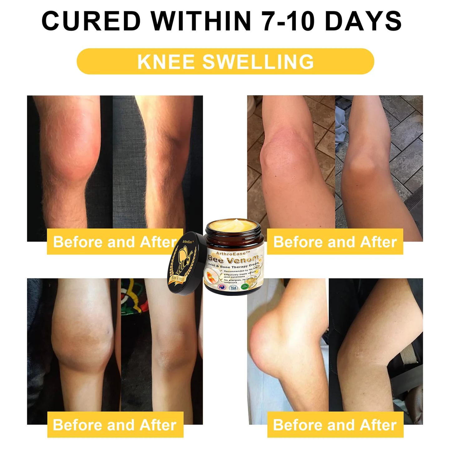 ArthroEase Bee Venom Arthritis Therapy Cream(Specially for older adults & AOA recommends)
