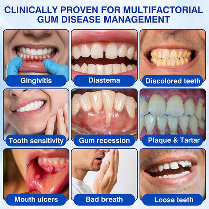 🦷 Healrize® GumRevive Gel for Regenerating the Tooth-Supporting Tissues (for Bleeding Gums, Receding Gums and Loose Teeth) 🐰