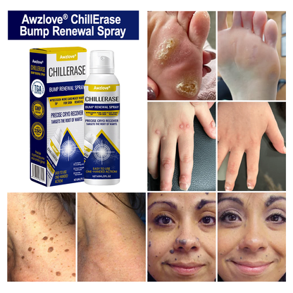Awzlove® ChillErase Bump Renewal Spray