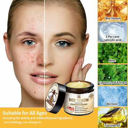 𝑇𝑢𝑟𝑜𝑛𝑢™ 𝑩𝒆𝒆 𝑽𝒆𝒏𝒐𝒎 𝑺𝒌𝒊𝒏 𝑻𝒓𝒆𝒂𝒕𝒎𝒆𝒏𝒕 𝑪𝒓𝒆𝒂𝒎🐝（𝑨𝑪𝑫 𝑅𝑒𝑐𝑜𝑚𝑚𝑒𝑛𝑑𝑒𝑑）