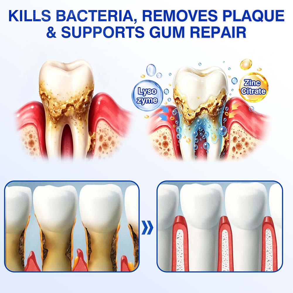 🦷 Healrize® GumRevive Gel for Regenerating the Tooth-Supporting Tissues (for Bleeding Gums, Receding Gums and Loose Teeth) 🐰