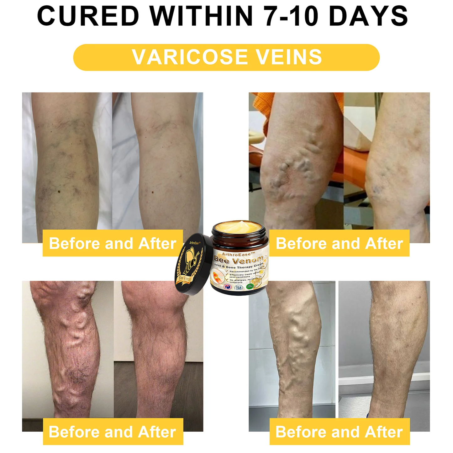 ArthroEase Bee Venom Arthritis Therapy Cream(Specially for older adults & AOA recommends)