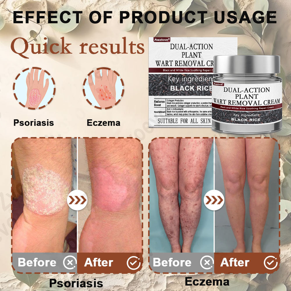 Awzlove® Black Rice Skin Repair Essence Cream ⚕️ TGA Certified (Removes warts and skin growths, improves keratin buildup and seborrheic dermatitis, follicular keratosis, age spots, and bruising)