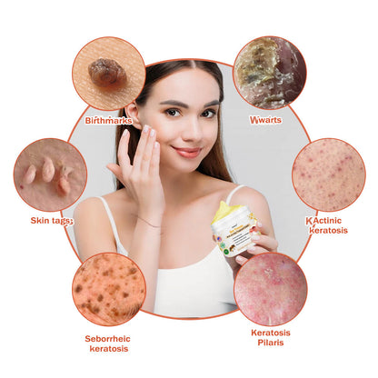 👩‍⚕️[🌟𝐎𝐟𝐟𝐢𝐜𝐢𝐚𝐥 𝐁𝐫𝐚𝐧𝐝 𝐒𝐭𝐨𝐫𝐞🌟] 𝐀𝐰𝐳𝐥𝐨𝐯𝐞™ 𝐁𝐞𝐞 𝐕𝐞𝐧𝐨𝐦 𝐌𝐨𝐥𝐞 𝐚𝐧𝐝 𝐖𝐚𝐫𝐭 𝐓𝐫𝐞𝐚𝐭𝐦𝐞𝐧𝐭 𝐂𝐫𝐞𝐚𝐦