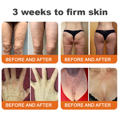 Awzlove® Luxurious Collagen & Stem Cell Anti-Cellulite Massage Oil💐 (🔥70% Off for a Limited Time!) 💐