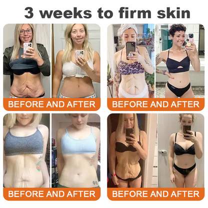 Awzlove® Luxurious Collagen & Stem Cell Anti-Cellulite Massage Oil💐 (🔥70% Off for a Limited Time!) 💐