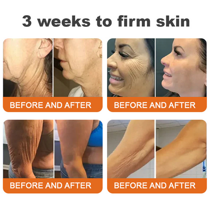 Awzlove® Luxurious Collagen & Stem Cell Anti-Cellulite Massage Oil💐 (🔥70% Off for a Limited Time!) 💐